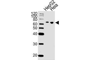 Lane 1: HepG2 Cell lysates, Lane 2: HeLa Cell lysates, probed with NLK (1146CT24. (Nemo-Like Kinase Antikörper)