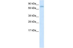 WB Suggested Anti-FUBP1 Antibody Titration:  1.