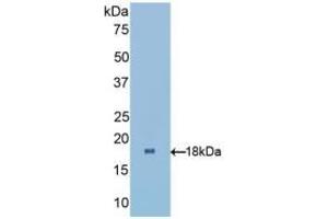 Detection of Recombinant RBP1, Human using Polyclonal Antibody to Retinol Binding Protein 1, Cellular (RBP1) (RBP1 Antikörper  (AA 2-135))