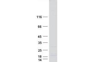 Validation with Western Blot (DYDC1 Protein (Myc-DYKDDDDK Tag))