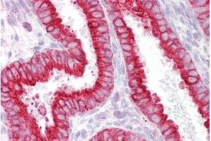 Immunohistochemistry (IHC) image for anti-Cholinergic Receptor, Nicotinic, beta 4 (Neuronal) (CHRNB4) (Internal Region) antibody (ABIN263180)