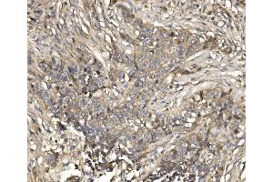 IHC analysis of EIF4EBP1 using anti-EIF4EBP1 antibody (ABIN7602881). (eIF4EBP1 Antikörper  (C-Term))