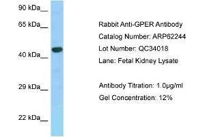 Western Blotting (WB) image for anti-G Protein-Coupled Estrogen Receptor 1 (GPER) (C-Term) antibody (ABIN2789079)