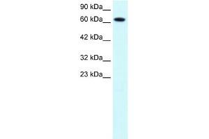 WB Suggested Anti-PIAS3 Antibody Titration:  1. (PIAS3 Antikörper  (C-Term))