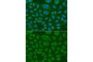 Immunofluorescence analysis of A549 cell using ANXA8L2 antibody. (ANXA8L2 Antikörper)