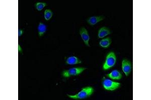Immunofluorescent analysis of A549 cells using ABIN7154384 at dilution of 1:100 and Alexa Fluor 488-congugated AffiniPure Goat Anti-Rabbit IgG(H+L) (GRAMD1B Antikörper  (AA 235-504))