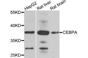 Western blot analysis of extracts of various cell lines, using CEBPA antibody.