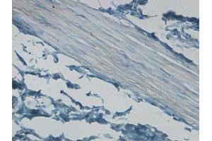 Immunohistochemical staining of formalin-fixed paraffin-embedded human stomach tissue showing cytoplasmic staining with CNN1 polyclonal antibody  at 1 : 100 dilution. (CNN1 Antikörper  (AA 150-250))