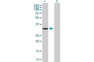 Western Blot analysis of ITPK1 expression in transfected 293T cell line by ITPK1 MaxPab polyclonal antibody. (ITPK1 Antikörper  (AA 1-314))