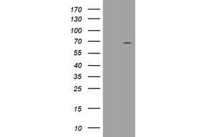 Image no. 16 for anti-DEAD (Asp-Glu-Ala-Asp) Box Polypeptide 59 (DDX59) (AA 1-303) antibody (ABIN1490728) (DDX59 Antikörper  (AA 1-303))