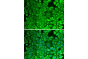 Immunofluorescence analysis of HeLa cells using GYS1 antibody (ABIN5971351). (Glycogen Synthase 1 Antikörper)