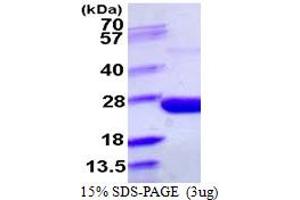SDS-PAGE (SDS) image for Ppa (AA 1-176) protein (His tag) (ABIN667500) (Ppa (AA 1-176) protein (His tag))