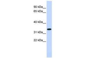 Image no. 1 for anti-Tripartite Motif Containing 14 (TRIM14) (AA 204-231) antibody (ABIN6740402) (TRIM14 Antikörper  (AA 204-231))