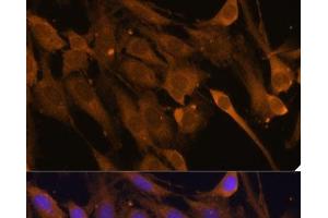 Immunofluorescence analysis of C6 cells using STUB1 Polyclonal Antibody at dilution of 1:100 (40x lens). (STUB1 Antikörper)