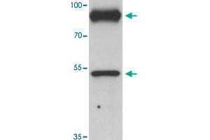 Western blot analysis of PRICKLE1 in human bladder tissue with PRICKLE1 polyclonal antibody  at 1 ug/mL. (PRICKLE1 Antikörper  (C-Term))