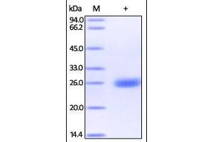 Human UCH-L1, His Tag on SDS-PAGE under reducing (R) condition. (UCHL1 Protein (AA 2-223) (His tag))
