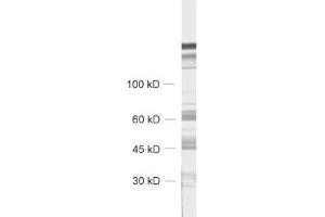 Western Blotting (WB) image for anti-Chromogranin B (Secretogranin 1) (CHGB) (AA 407-677) antibody (ABIN1742518)