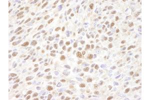 Immunohistochemistry (IHC) image for anti-Valosin Containing Protein (VCP) (C-Term) antibody (ABIN7448858)