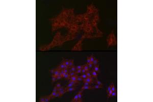 Immunofluorescence analysis of PC-12 cells using  Rabbit mAb (ABIN7265385) at dilution of 1:100 (40x lens). (ARPC2 Antikörper)