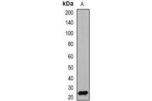 Western blot analysis of PSMD10 expression in SW620 (A) whole cell lysates.