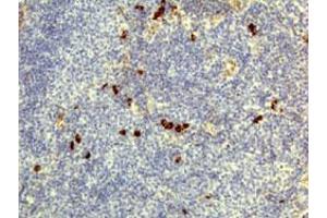 Immunohistochemical staining (Formalin-fixed paraffin-embedded sections) of human lymphoid tissue with Human IgD monoclonal antibody, clone RM123  under 1 ug/mL working concentration. (IgD Antikörper)