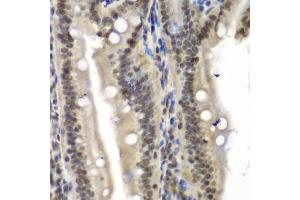 Immunohistochemistry of paraffin-embedded mouse Intestine using NELFE antibody. (RDBP Antikörper)