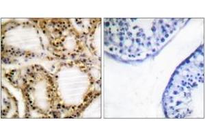 Immunohistochemistry analysis of paraffin-embedded human testis, using Retinoblastoma (Phospho-Thr821) Antibody. (Retinoblastoma Protein (Rb) Antikörper  (pThr821))