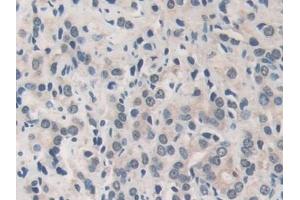 Immunohistochemistry (IHC) image for anti-Matrix Metallopeptidase 19 (MMP19) (AA 98-508) antibody (ABIN7434200)