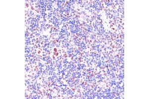 Immunohistochemistry of paraffin-embedded rat spleen using KDM1 antibody (ABIN7268323) at dilution of 1:100 (40x lens). (LSD1 Antikörper  (AA 130-380))