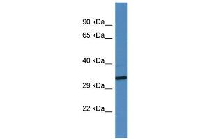 Western Blotting (WB) image for anti-Golgin A6 Family-Like 2 (GOLGA6L2) (Middle Region) antibody (ABIN2788891) (GOLGA6L2 Antikörper  (Middle Region))