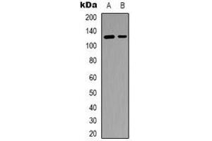 Western blot analysis of SFRS15 expression in RT4 (A), Colo205 (B) whole cell lysates. (SCAF4 Antikörper)