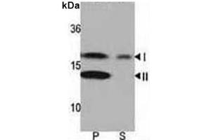 Western blot analysis of LC3 antibody and rat brain lysate: Both lipidated (arrow, II) and non-lipidated (arrow, I) were detected in membrane fraction (P) but only non-lipidated LC3 was detected in soluble fraction (S).