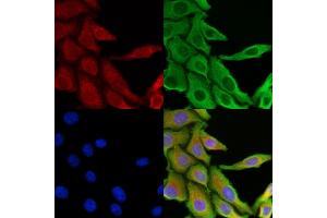 ABIN6266031 and ABIN6269398 staining HepG2 cells by IF/ICC. (WNK1 Antikörper  (N-Term))