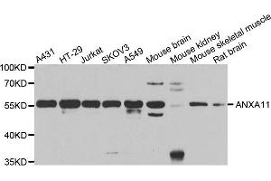 Western blot analysis of extracts of various cell lines, using ANXA11 antibody.