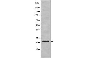 Western blot analysis of TMEM37 using HUVEC whole cell lysates (TMEM37 Antikörper  (N-Term))