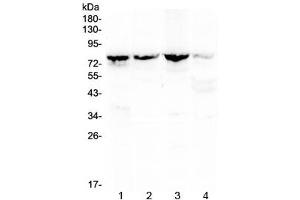 Western blot testing of 1) rat kidney, 2) mouse kidney, 3) mouse lung and 4) human MCF7 lysate with Calpain 2 antibody at 0. (Calpain 2 Antikörper)