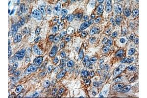 Immunohistochemical staining of paraffin-embedded colon using anti-KRT18 (ABIN2452646) mouse monoclonal antibody. (Cytokeratin 18 Antikörper  (AA 69-372))