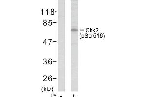 Image no. 1 for anti-Checkpoint Kinase 2 (CHEK2) (pSer516) antibody (ABIN196866) (CHEK2 Antikörper  (pSer516))