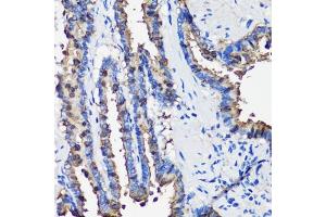 Immunohistochemistry of paraffin-embedded rat lung using SCGB1 antibody (6997) at dilution of 1:100 (40x lens). (SCGB1A1 Antikörper  (AA 22-91))