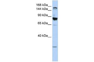 WB Suggested Anti-TJP2  Antibody Titration: 0. (TJP2 Antikörper  (Middle Region))