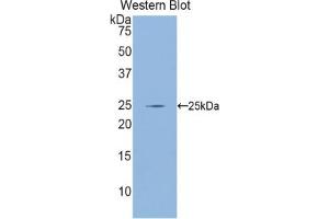 Detection of Recombinant GCLC, Mouse using Polyclonal Antibody to Glutamate Cysteine Ligase, Catalytic (GCLC) (GCLC Antikörper  (AA 435-636))