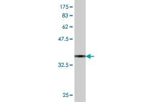 Western Blot detection against Immunogen (36. (TIAM2 Antikörper  (AA 527-624))