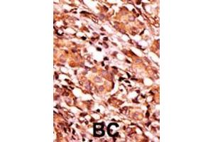 Immunohistochemistry (Paraffin-embedded Sections) (IHC (p)) image for anti-BCL2-Associated Agonist of Cell Death (BAD) (pSer134) antibody (ABIN389519)