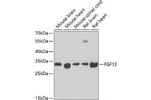 Western blot analysis of extracts of various cell lines using FGF13 Polyclonal Antibody at dilution of 1:1000. (FGF13 Antikörper)