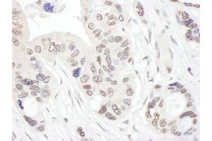 Immunohistochemistry (IHC) image for anti-NHP2 Non-Histone Chromosome Protein 2-Like 1 (NHP2L1) (AA 71-121) antibody (ABIN7453472) (NHP2L1 Antikörper  (AA 71-121))