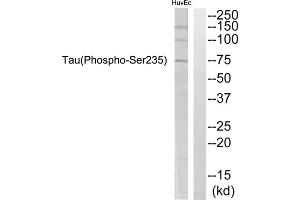 Western blot analysis of extracts from HuvEc cells, using Tau (Phospho-Ser235) Antibody. (tau Antikörper  (pSer235))