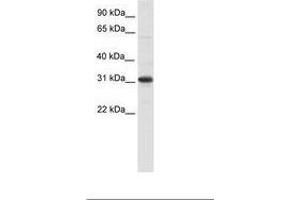 Image no. 1 for anti-Nuclear Receptor Interacting Protein 2 (NRIP2) (AA 27-76) antibody (ABIN6736079) (NRIP2 Antikörper  (AA 27-76))