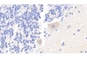 Immunohistochemistry (IHC) image for anti-Vascular Endothelial Growth Factor A (VEGFA) (AA 27-190) antibody (ABIN7431194)