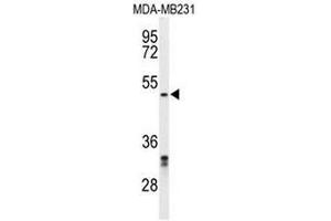 Western blot analysis of CBX2 Antibody (N-term) in MDA-MB231 cell line lysates (35µg/lane). (CBX2 Antikörper  (N-Term))