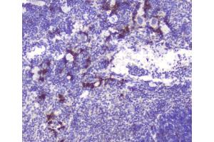 IHC analysis of RASAL1 using anti-RASAL1 antibody (ABIN6719367). (RASAL1 Antikörper  (AA 721-798))